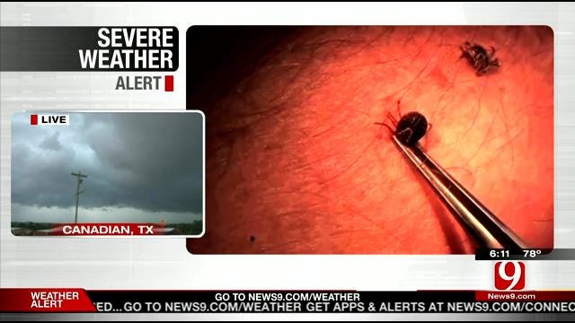 Health Official Speaks Out About Rare Tick Virus Confirmed In Oklahoma