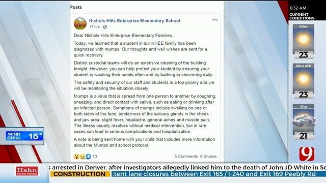 Nichols Hills Elementary School Sanitizes Following Confirmed Mumps Case