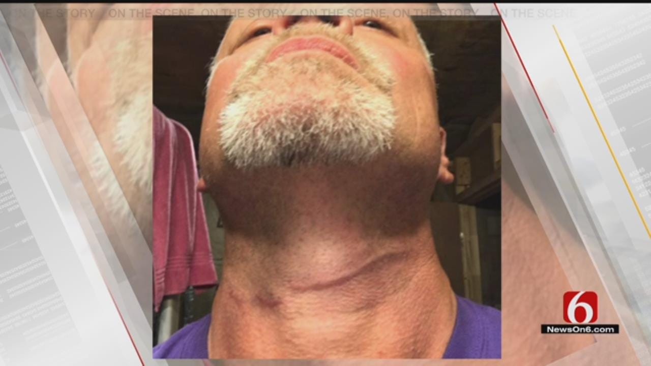 Osage County Man Catches Wire On Neck Riding Motorcycle On Highway